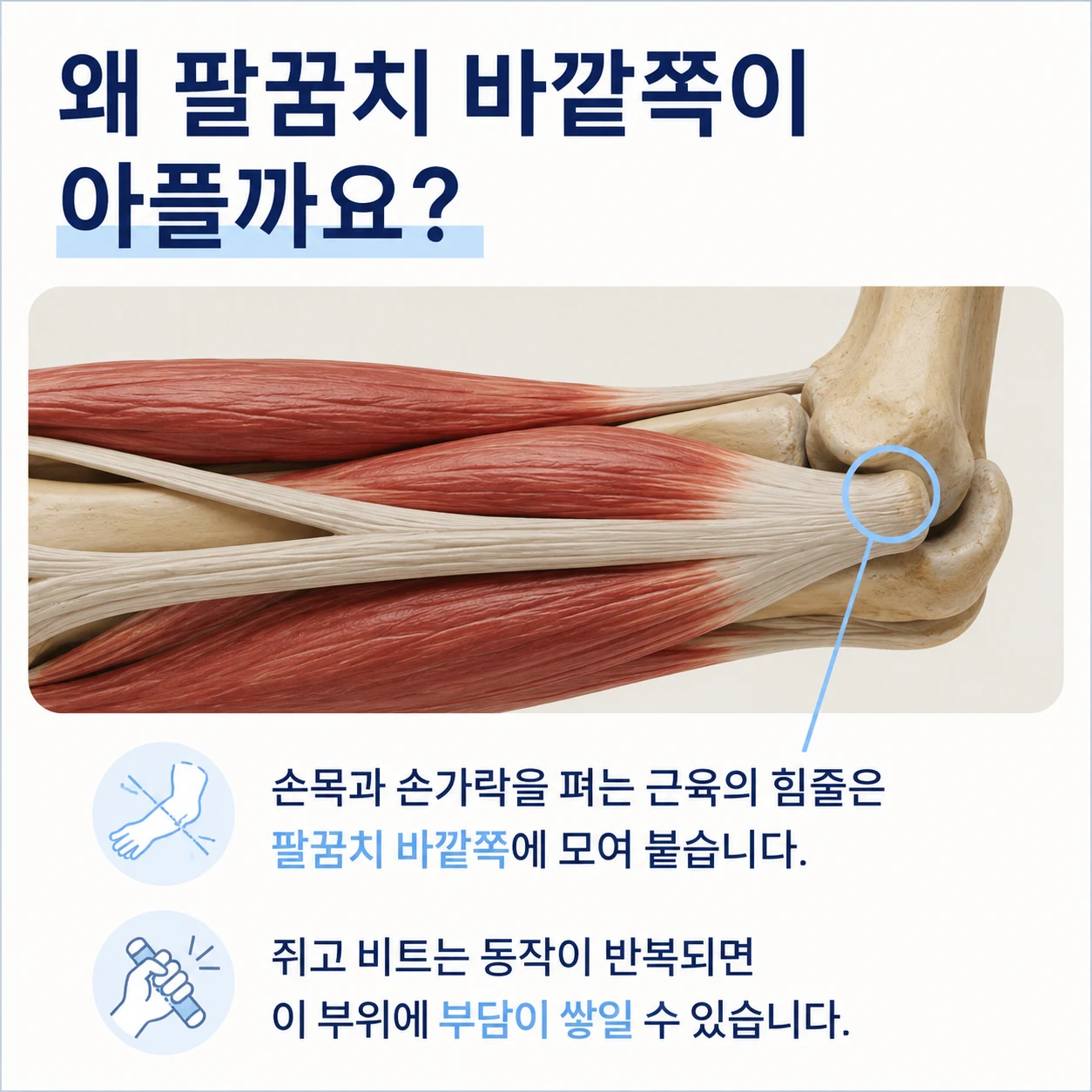 팔꿈치 바깥쪽에 모여 붙는 손목과 손가락 폄근 힘줄