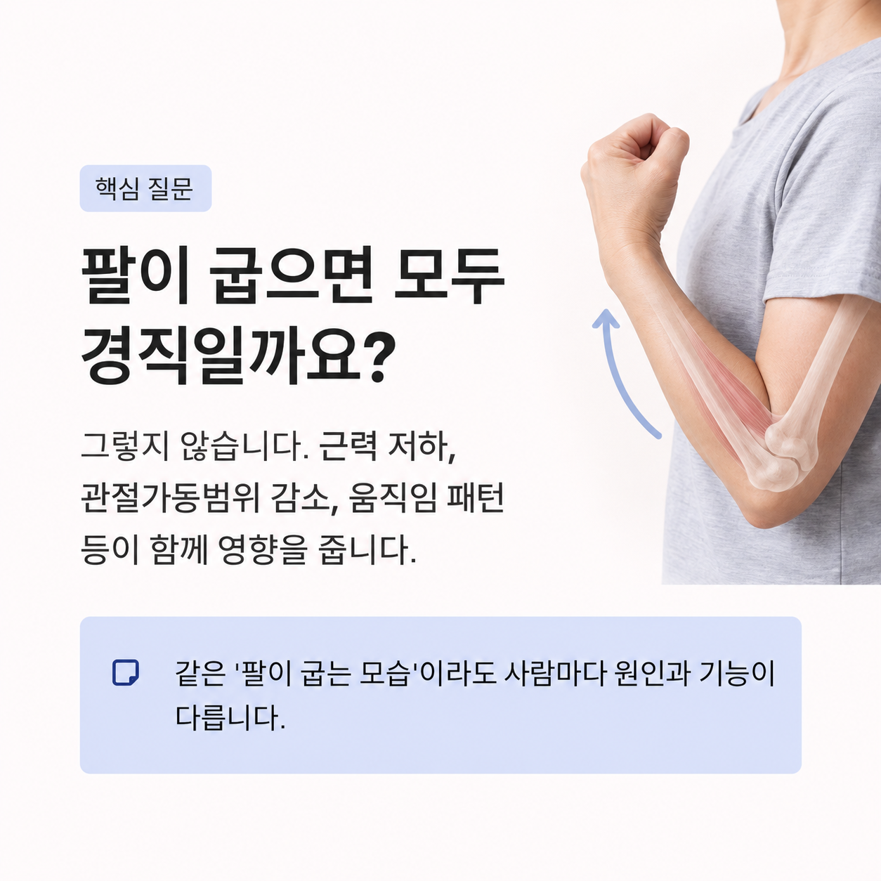 팔만이 아니라 몸통과 보행까지 함께 확인하는 이유